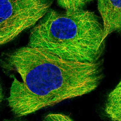 Immunocytochemistry/Immunofluorescence: MAP4 Antibody [NBP1-89483] - Immunofluorescent staining of human cell line A-431 shows localization to plasma membrane, cytosol & microtubules.
