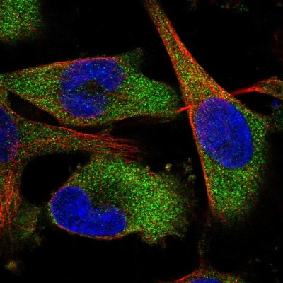 Immunocytochemistry/Immunofluorescence: QARS Antibody [NBP1-89487] - Immunofluorescent staining of human cell line U-251 MG shows localization to cytosol.