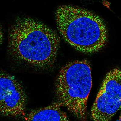 Immunocytochemistry/Immunofluorescence: OSBPL2 Antibody [NBP1-92236] - Immunofluorescent staining of human cell line U-2 OS shows localization to cytosol.