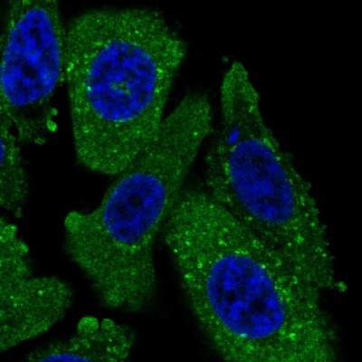 Immunocytochemistry/Immunofluorescence: TPD52L2/D54 Antibody [NBP2-13468] - Immunofluorescent staining of human cell line PC-3 shows localization to cytosol & vesicles.