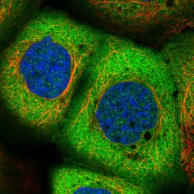 Immunocytochemistry/Immunofluorescence: NARS Antibody [NBP2-13640] - Immunofluorescent staining of human cell line A-431 shows localization to cytosol.