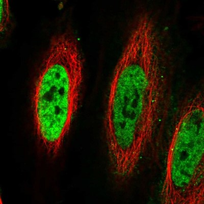 Immunocytochemistry/Immunofluorescence: TDG Antibody [NBP2-13423] - Immunofluorescent staining of human cell line HeLa shows localization to nucleoplasm.