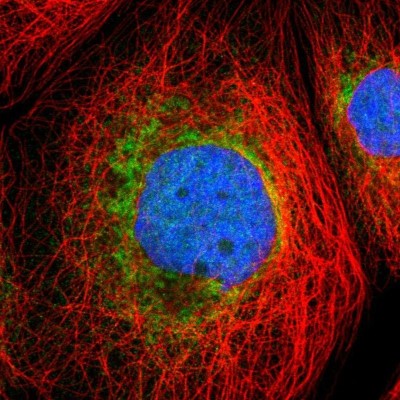 Immunocytochemistry/Immunofluorescence: DLGAP2 Antibody [NBP1-90602] - Staining of human cell line A-431 shows positivity in nucleus and endoplasmic reticulum.
