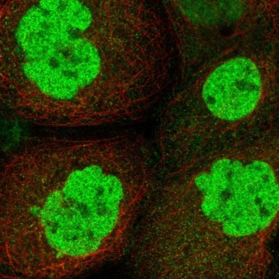 Immunocytochemistry/Immunofluorescence: RMND1 Antibody [NBP1-90033] - Staining of human cell line A-431 shows positivity in nucleus but not nucleoli.