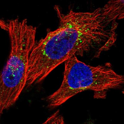 Immunocytochemistry/Immunofluorescence: ITM2B Antibody [NBP1-88354] - Immunofluorescent staining of human cell line U-251 MG shows localization to the Golgi apparatus & vesicles.