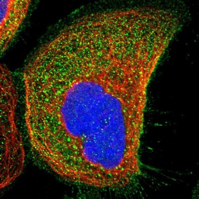 Immunocytochemistry/Immunofluorescence: WDR53 Antibody [NBP1-82758] - Immunofluorescent staining of human cell line A-431 shows localization to plasma membrane & cytosol.