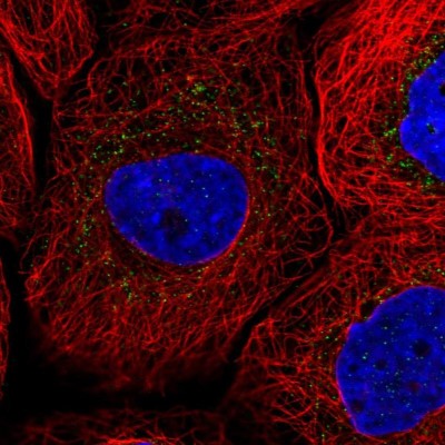 Immunocytochemistry/Immunofluorescence: SCP2 Antibody [NBP1-85958] - Immunofluorescent staining of human cell line A-431 shows localization to vesicles.