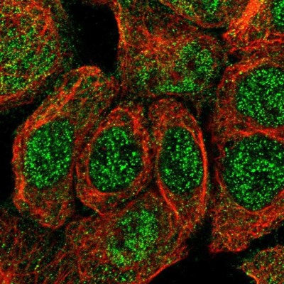 Immunocytochemistry/Immunofluorescence: TRIM65 Antibody [NBP1-86017] - Staining  of human cell line A-431 shows positivity in nucleus but not nucleoli and cytoplasm.