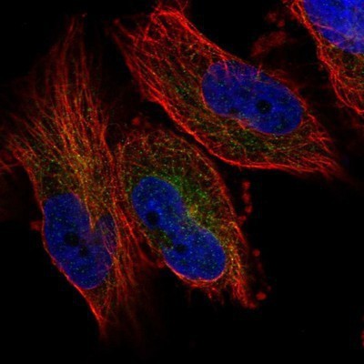 Immunocytochemistry/Immunofluorescence: SH3GL2 Antibody [NBP1-85521] - Staining of human cell line U-251 MG shows positivity in cytoplasm.