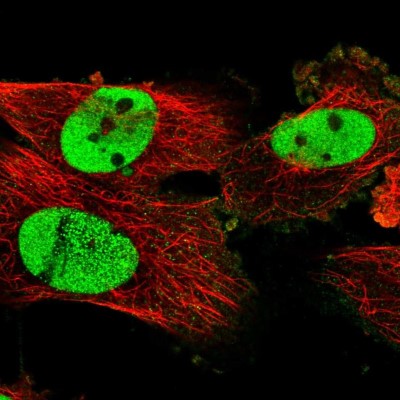 Immunocytochemistry/Immunofluorescence: SCC112 Antibody [NBP1-87904] - Immunofluorescent staining of human cell line U-251 MG shows localization to nucleoplasm.