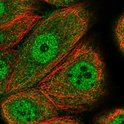 Immunocytochemistry/Immunofluorescence: CCDC112 Antibody [NBP2-14442] - Immunofluorescent staining of human cell line MCF7 shows localization to nucleoplasm & cytosol.