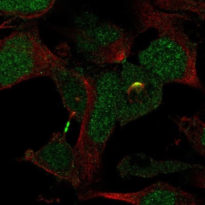 Immunocytochemistry/Immunofluorescence: KATNBL1 Antibody [NBP2-31859] - Staining of human cell line AF22 shows localization to nucleus, midbody & mitotic spindle.