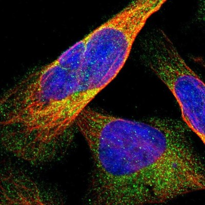 Immunocytochemistry/Immunofluorescence: DDHD2 Antibody [NBP1-82965] - Immunofluorescent staining of human cell line U-2 OS shows localization to cytosol.