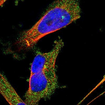 Immunocytochemistry/Immunofluorescence: DDHD2 Antibody [NBP1-82965] - Staining of human cell line U-251MG shows positivity in cytoplasm and centrosome.