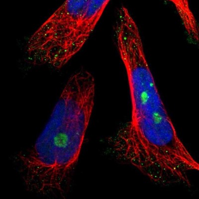 Immunocytochemistry/Immunofluorescence: NOP58 Antibody [NBP1-81680] - Staining of human cell line U-251 MG shows localization to nucleoli fibrillar center.