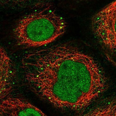 Immunocytochemistry/Immunofluorescence: DMP-1 Antibody [NBP1-89484] - Staining of human cell line A-431 shows positivity in nucleus but not nucleoli & vesicles.