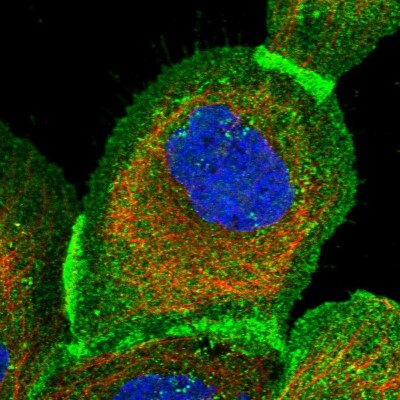 Immunocytochemistry/Immunofluorescence: PPTC7 Antibody [NBP1-90654] - Immunofluorescent staining of human cell line A-431 shows localization to plasma membrane & cytosol.