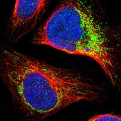 Immunocytochemistry/Immunofluorescence: CCDC44 Antibody [NBP1-88160] - Immunofluorescent staining of human cell line U-2 OS shows localization to nucleus & mitochondria.