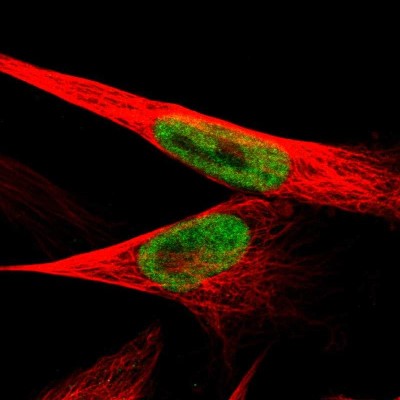 Immunocytochemistry/Immunofluorescence: JMJD1B Antibody [NBP1-88256] - Immunofluorescent staining of human cell line U-251 MG shows localization to nucleoplasm.