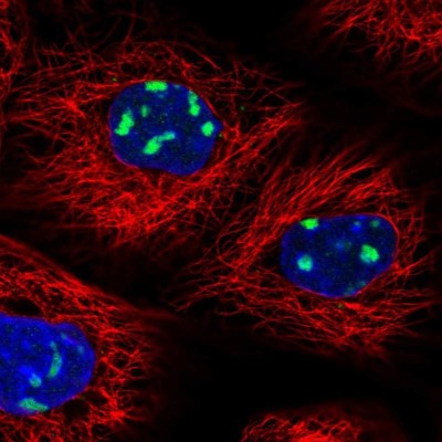Immunocytochemistry/Immunofluorescence: UTP6 Antibody [NBP1-88468] - Immunofluorescent staining of human cell line A-431 shows localization to nucleoli.