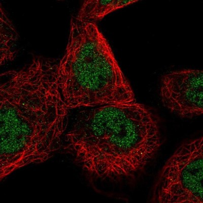 Immunocytochemistry/Immunofluorescence: CDK20 Antibody [NBP1-91214] - Staining of human cell line A-431 shows positivity in nucleus but not nucleoli.