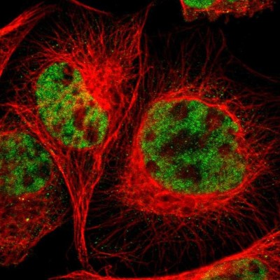 Immunocytochemistry/Immunofluorescence: RGAG4 Antibody [NBP1-93561] - Immunofluorescent staining of human cell line A-431 shows localization to nucleoplasm.