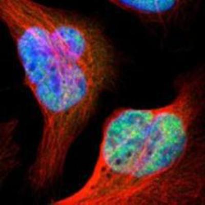 Immunocytochemistry/Immunofluorescence: PARN Antibody [NBP1-84302] - Staining of human cell line U-2 OS shows positivity in nuclei but not nucleoli.