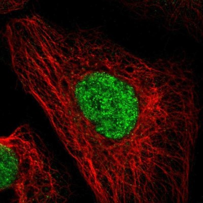Immunocytochemistry/Immunofluorescence: DACH1 Antibody [NBP1-85320] - Staining of human cell line A-431 shows localization to nucleoplasm & vesicles.