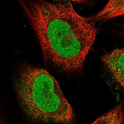 Immunocytochemistry/Immunofluorescence: TXNDC9 Antibody [NBP1-89052] - Staining of human cell line U-251 MG shows positivity in nucleus but not nucleoli, nuclear membrane and cytoplasm.