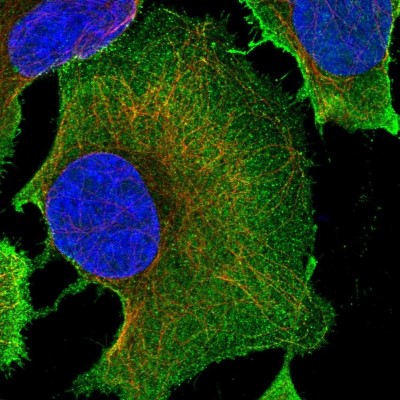 Immunocytochemistry/Immunofluorescence: PLD1 Antibody [NBP2-34078] - Immunofluorescent staining of human cell line U-2 OS shows localization to plasma membrane.