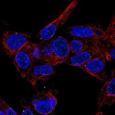 Immunofluorescence: FAM125B Antibody [NBP2-13979] - Immunofluorescent staining of human cell line Hep G2 shows localization to vesicles. Antibody staining is shown in green.