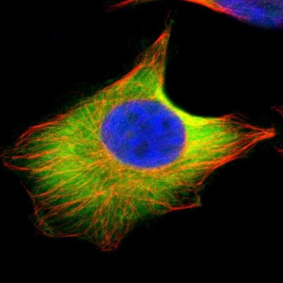 Immunocytochemistry/Immunofluorescence: UBE2D4/Ubch5d Antibody [NBP1-81769] - Staining of human cell line U-251 MG shows localization to plasma membrane & cytosol.