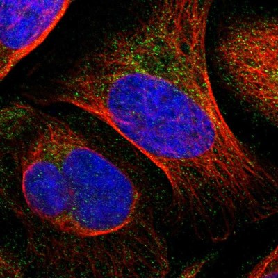 Immunocytochemistry/Immunofluorescence: ARMC7 Antibody [NBP1-82129] - Immunofluorescent staining of human cell line U-2 OS shows localization to cytosol.
