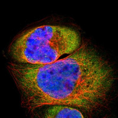 Immunocytochemistry/Immunofluorescence: PSMD8 Antibody [NBP1-83254] - Immunofluorescent staining of human cell line A-431 shows localization to cytosol.
