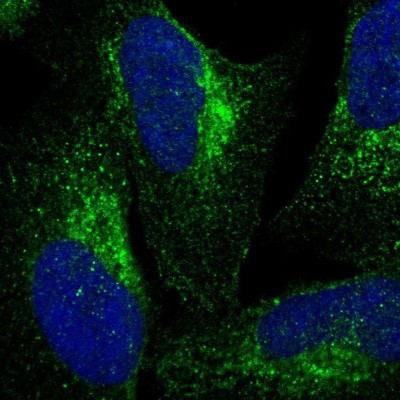 Immunocytochemistry/Immunofluorescence: VPS53 Antibody [NBP1-83798] - Staining of human cell line U-2 OS shows localization to cytosol & the Golgi apparatus.