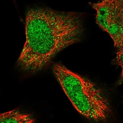Immunocytochemistry/Immunofluorescence: RASAL2 Antibody [NBP1-82578] - Staining of human cell line U-251MG shows positivity in nucleus but not nucleoli and vesicles.