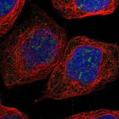 Immunocytochemistry/Immunofluorescence: NLE1 Antibody [NBP1-83860] - Staining of human cell line A-431 shows positivity in nucleus and nucleoli.
