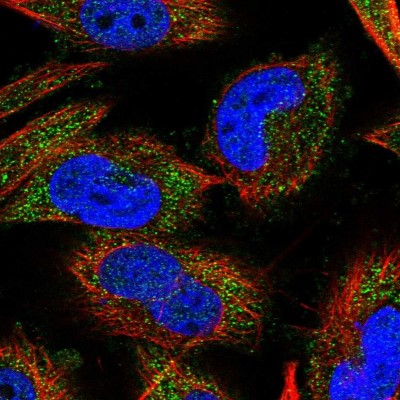Immunocytochemistry/Immunofluorescence: CNOT6L Antibody [NBP1-84186] - Immunofluorescent staining of human cell line U-251 MG shows localization to cytosol.