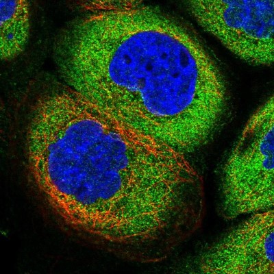 Immunocytochemistry/Immunofluorescence: AHCYL1 Antibody [NBP1-83093] - Immunofluorescent staining of human cell line A-431 shows localization to cytosol.