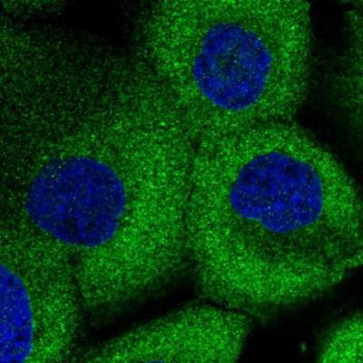 Immunocytochemistry/Immunofluorescence: Synaptojanin 2 Antibody [NBP1-87843] - staining of human cell line A-431 shows localization to microtubules. Antibody staining is shown in green.