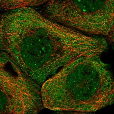 Immunocytochemistry/Immunofluorescence: PHF22 Antibody [NBP1-92263] - Immunofluorescent staining of human cell line A-431 shows localization to nuclear bodies & cytosol.