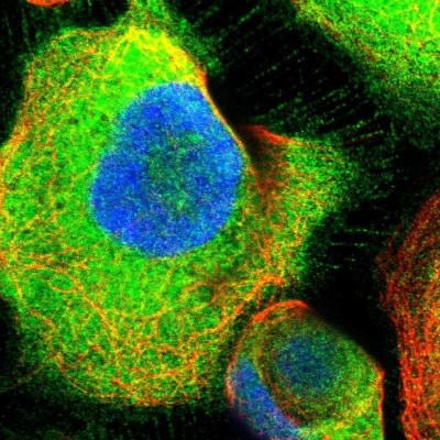 Immunocytochemistry/Immunofluorescence: ATIC Antibody [NBP1-89192] - Staining of human cell line A-431 shows positivity in plasma membrane and cytoplasm.