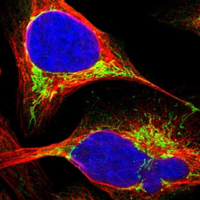 Immunocytochemistry/Immunofluorescence: ECHS1 Antibody [NBP1-87078] - Immunofluorescent staining of human cell line U-2 OS shows localization to mitochondria.