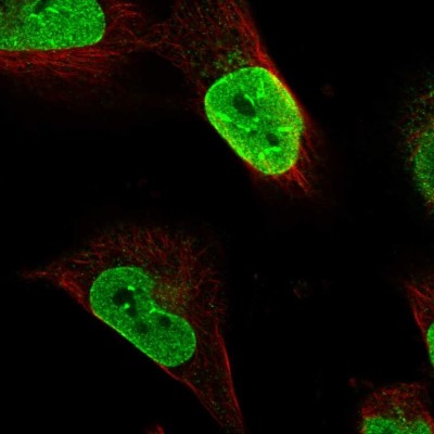 Immunocytochemistry/Immunofluorescence: FAM188A Antibody [NBP1-88543] - Immunofluorescent staining of human cell line U-251 MG shows localization to nucleoplasm & nuclear membrane.