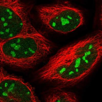 Immunocytochemistry/Immunofluorescence: Semaphorin 3F Antibody [NBP1-90665] - Staining of human cell line U-2 OS shows positivity in nucleus and nucleoli.