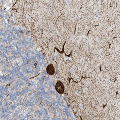 Immunohistochemistry-Paraffin: Semaphorin 3F Antibody [NBP1-90665] - Staining of human cerebellum shows strong cytoplasmic positivity in Purkinje cells.