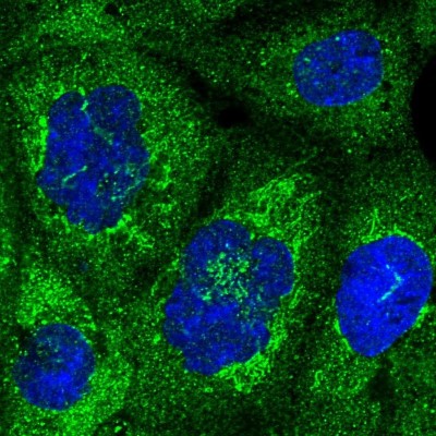 Immunocytochemistry/Immunofluorescence: NUPL1 Antibody [NBP2-13684] - Immunofluorescent staining of human cell line A-431 shows localization to plasma membrane, cytosol & mitochondria.