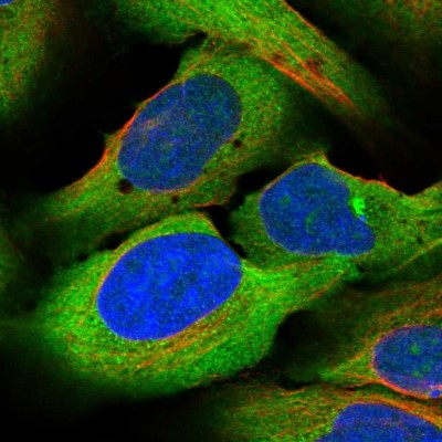 Immunocytochemistry/Immunofluorescence: ZC3H15 Antibody [NBP1-81313] - Immunofluorescent staining of human cell line U-2 OS shows localization to nucleoli & cytosol.