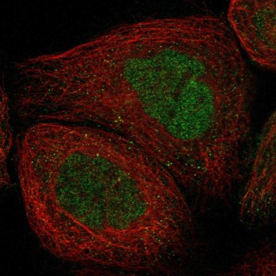 Immunocytochemistry/Immunofluorescence: MTHFD2L Antibody [NBP1-82663] - Staining of human cell line A-431 shows positivity in nucleus but not nucleoli.