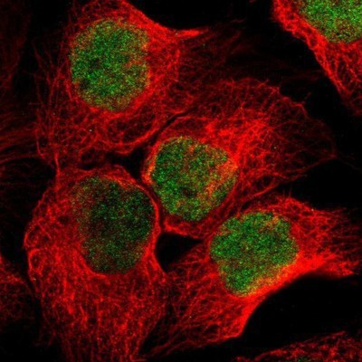 Immunocytochemistry/Immunofluorescence: WHSC1 Antibody [NBP1-82633] - Staining of human cell line A-431 shows positivity in nucleus but not nucleoli.